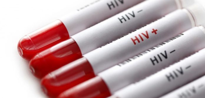HIV