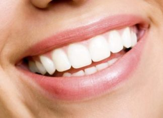 Trajtim natyral për largimin e tartarit të dhëmbëve (recetë)