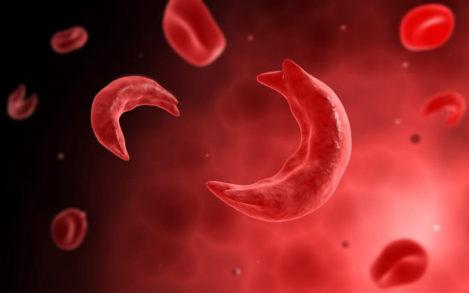 SCD AMENIa