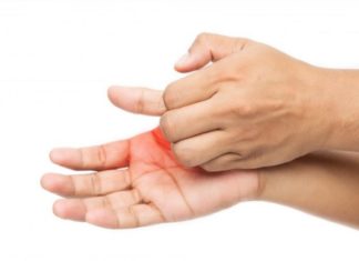 Si t’i mposhtni alergjitë e duarve?