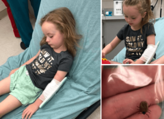 Vajza pesëvjeçare u zgjua e paralizuar, nëna apelon: Kontrolloni rregullisht fëmijët tuaj!