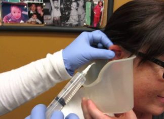 Pastrimi i veshëve: Kur është i nevojshëm dhe si bëhet?