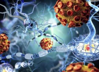 Dhimbjet dhe pagjumësia, shenja paralajmëruese të multiple sklerozës