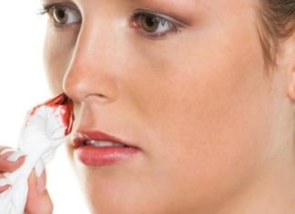 Gjakderdhja nga hunda mund të jetë diçka serioze