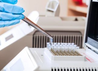 Testi i ri gjenetik parashikon rrezikun e pesë sëmundjeve serioze