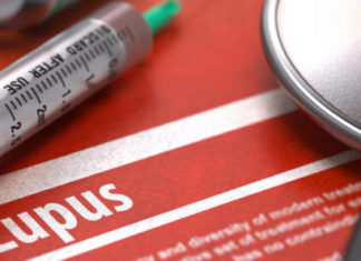 Lupusi – sëmundja e cila zakonisht i prek gratë e reja