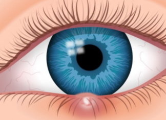 Elbi i syrit – Si dhe pse paraqitet?