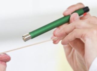 Këto shenja tregojnë kancerin e gjuhës: Nëse i vini re, menjëherë te mjeku!