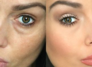 Këtë simptomë nuk duhet ta injoroni: Ja për çfarë problemi flasin qeskat e syve!