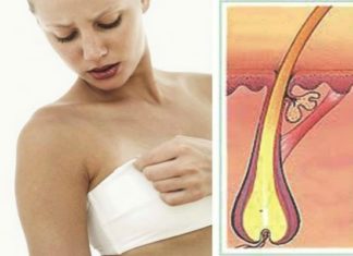 Kur qimet rreth thithkave bëhen shqetësuese?