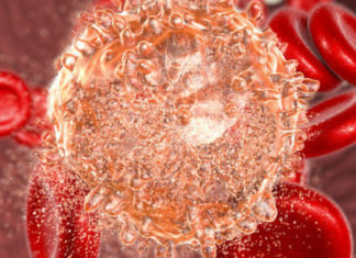 Simptomat dhe diagnostifikimi i leukemisë