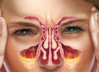 Truke për pastrimin e sinuseve dhe hundët e bllokuara