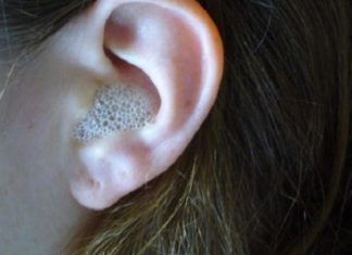 Këshilla mjekësore: Si t’i pastroni veshët e bllokuar