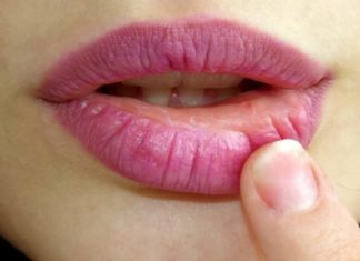 Mos e shtyni mjekimin: Tre shenjat që tregojnë se trupi lufton me aneminë e rrezikshme