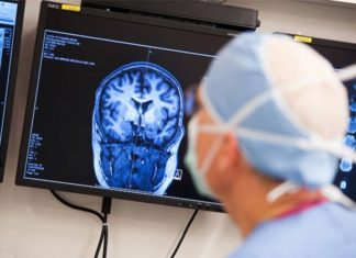 Të prekurit nga epilepsia janë të ekspozuar ndaj një rreziku më të madh të zhvillimit të depresionit