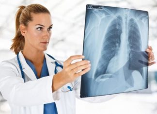 Simptomat e kancerit të mushkërive që duhet t’i njohin edhe jo-duhanpirësit