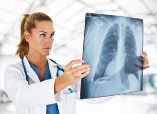 Barnat e ndryshme psikiatrike mund të rrisin rrezikun e inflamacionit të mushkërive