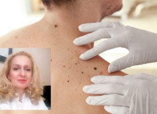 Dr. Verçe Todorovska: Bëni skrining falas, në mënyrë që të mos humbim betejën me melanomën!