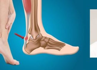 Dr. Dimitar Spoa: Trajtimi kirurgjik i tendinit të dhimbshëm të Akilit