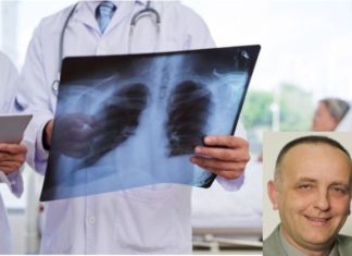 Prof. Dr. Jordan Minov: Si mund të parandalohet bronkiektaza