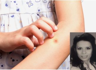 Dr. Ana Ristovska-Dimitrovska: Pickimet e insekteve – si t’i trajtojmë ato?