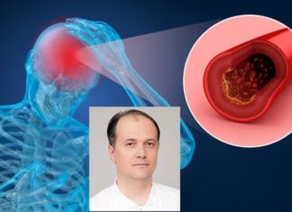 Mr. Spec. Dr. Goran Kolevski: Pse është i rëndësishëm diagnostikimi në kohë i ngushtimit ose bllokim i plotë i arterieve karotide, cilët janë shkaktarët më të zakonshëm të sulmit në tru?