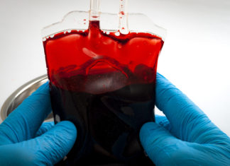 COVID-19: A ju bën lloji i gjakut më të ndjeshëm ndaj marrjes së koronavirusit?