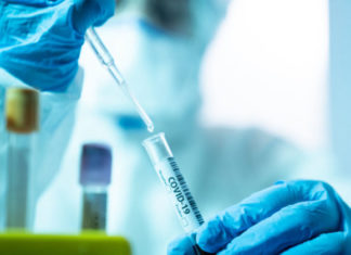 Modeli i zhvilluar me shënuesit biologjikë që zbulon pacientët me rrezikun më të lartë të vdekjes nga COVID-19