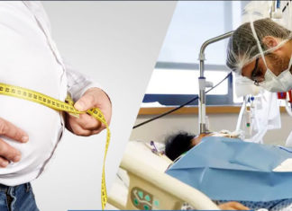 Obeziteti dhe COVID-19 janë kombinim vrasës: Rreziku i vdekjes rritet në mënyrë dramatike me rritjen e indeksit të masës trupore