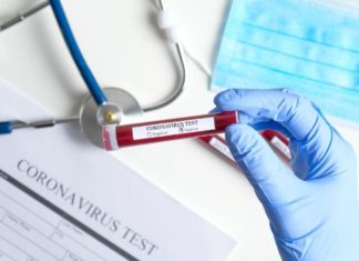 HULUMTIMI KONFIRMON: Testet e rreme-pozitive për koronavirusin e ri janë të mundshme dhe shumica e infeksioneve janë ngjitëse në vetëm një javë