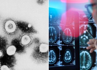 HULUMTIM I RI PËR PASOJAT E COVID-19: “Truri i disa pacientëve është më i vjetër për pothuajse 10 vjet”