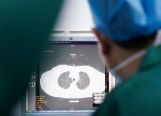 NJË TJETËR HULUMTIM KONFIRMON: COVID-19 shkakton ndërlikime në mushkëri, veshka dhe zemër