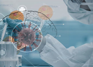 SIMPTOMAT NEUROLOGJIKE TË COVID-19: Mikroinfarkti, sulmi në tru, vdekja e qelizave – Koronavirusi infekton qelizat e trurit dhe shkakton dëmtime të rënda të indeve të trurit