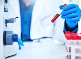 HULUMTIM: SARS-CoV-2 mund të fshihet në tru dhe të shkaktojë përsëritje të sëmundjes