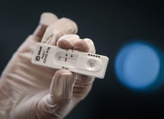 Zhvillohet testi i shpejtë PCR i cili zbulon llojin britanik të koronavirusit