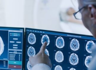 Pse ndodh ndryshimi i gjendjes emocionale te pacientët me COVID-19?