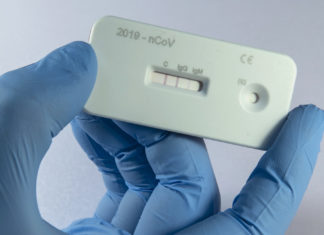 ÇFARË KËSHILLOJNË MJEKËT: A duhet të bëni testin për antitrupa përpara se të merrni dozën e tretë të vaksinës COVID-19?