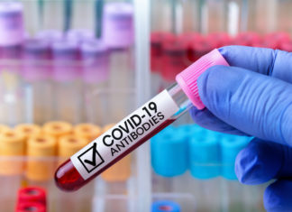 MBROJTJE PROBLEMATIKE: Po sikur të mos kemi antitrupa pasi e kalojmë omicronin – COVID-19