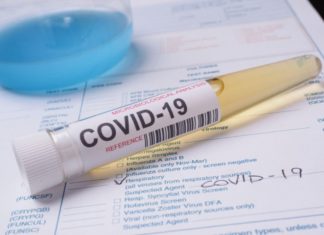 JENI TË LODHUR, DEPRESIV, JU BIEN FLOKËT, KENI VËSHTIRËSI ME FRYMËMARRJEN: Ndoshta është post-kovidi dhe këto janë simptomat më të zakonshme