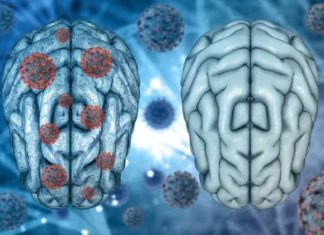 SIPAS SHKENCËTARËVE BRITANIK, NUK KA RËNDËSI NËSE KENI KALUAR KOVIDIN E LEHTË APO TË RËNDË: Sëmundja mund të lërë shenjë në tru, si zvogëlimi i masës gri