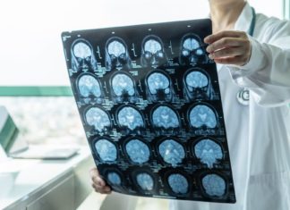 HULUMTIM: Nuk ka rritje të rrezikut të gjendjeve neurologjike pas vaksinimit kundër koronavirusit