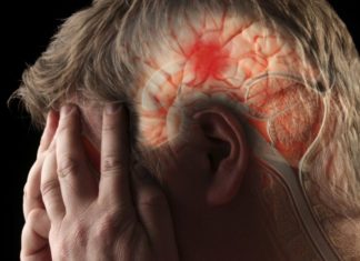 SI TË BËNI DALLIMIN: Disa simptoma mund të ngjajnë me ato të sulmit në tru, por nuk është ai