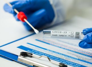 TË DREJTAT E PACIENTIT: Sa ditë pushim mjekësor u takojnë kur jeni të sëmurë me COVID-19 dhe a keni të drejtë për ekzaminim falas të D-dimerave dhe CRP?