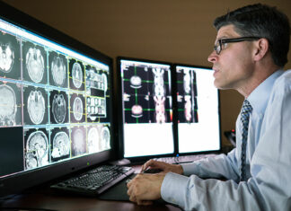 STUDIM I RI: Disa lloje të kancerit të gjirit mund të kurohen pa rrezatim