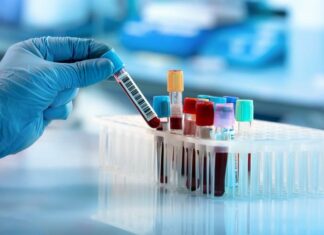 A e dini se cila sëmundje e rrezikshme ju kërcënon në varësi të grupës së gjakut?