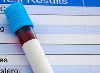 GRUPET E CENUESHME: Nivelet normale të kolesterolit në gjak – a janë të njëjta për të gjithë?