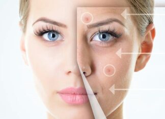 ÇFARË TREGOJNË STUDIMET: A mund të jenë aknet një nga simptomat e kancerit?