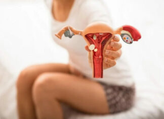 Endometrioza lidhet me rrezikun e sëmundjeve kardiovaskulare tek gratë
