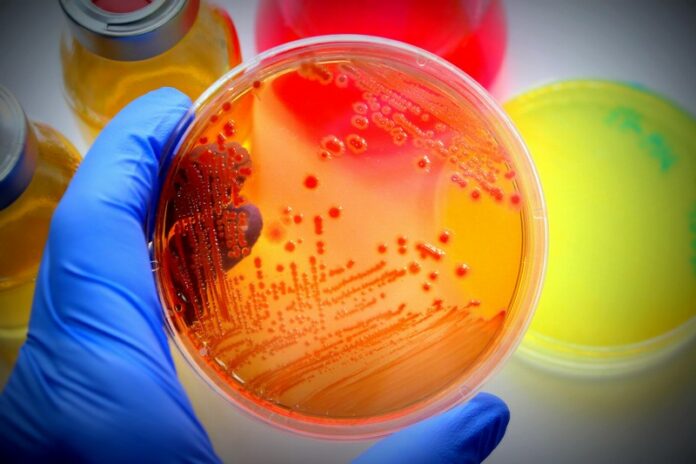 e-coli-3-696x464